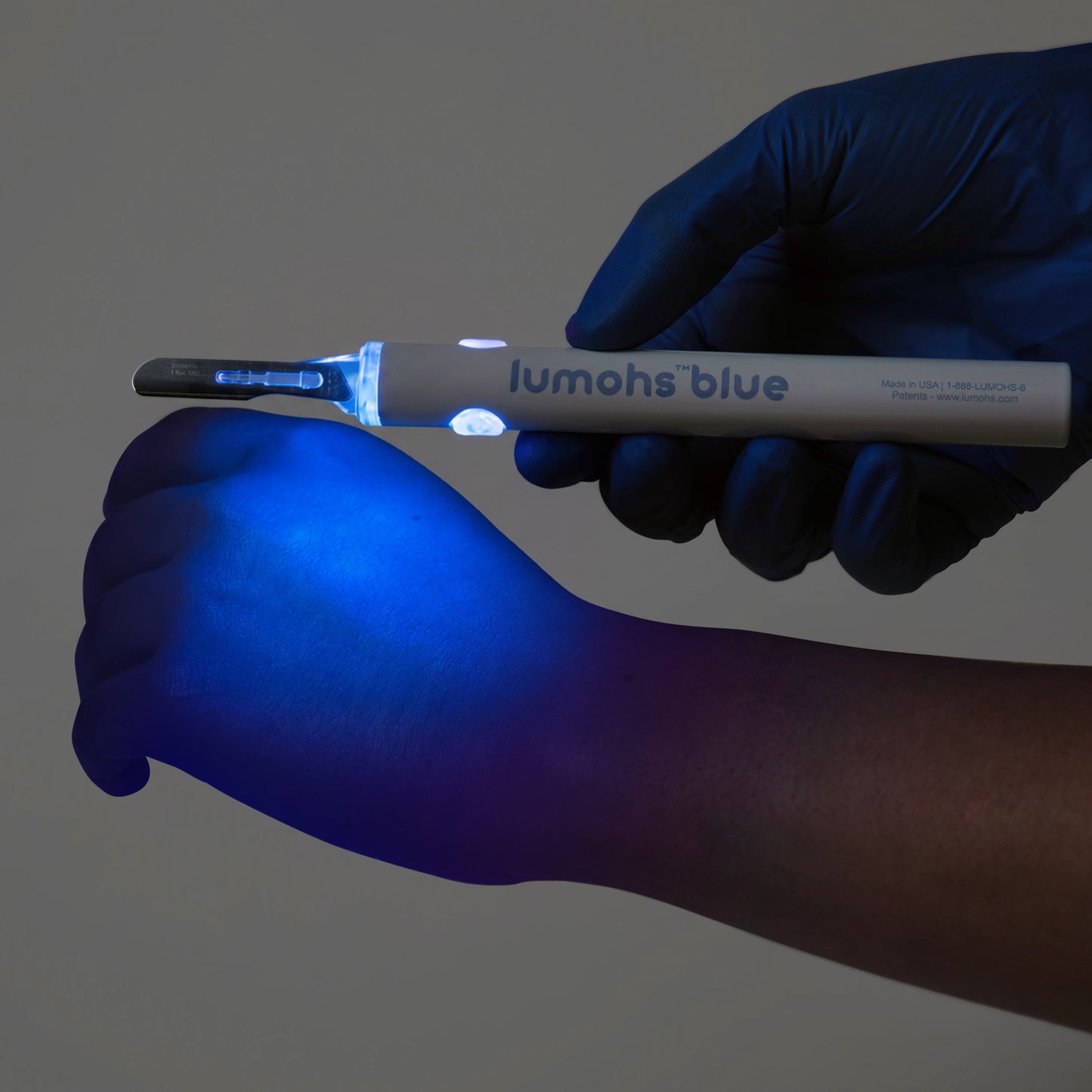 Lumohs Blue — Blade Kit- Coming soon.
